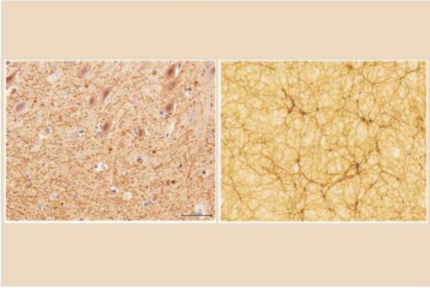 Human Brain & Universe Similarities