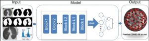 AI Screen CT Images For COVID