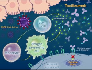 Tocilizumab For Severe COVID Pneumonia