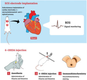 Sudden Death In A Rat Model Of Parkinson’s Disease