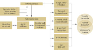 Hypertension, Alzheimer’s & Dementia