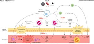 Inflammatory Lung Disease & Implications For COVID