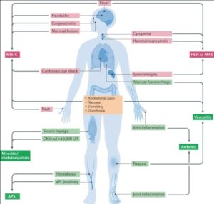 Organ Specific COVID-19