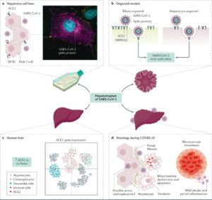 COVID & Liver Disease