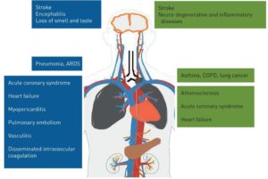 Impact Of Outdoor Air Pollution On COVID