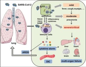 Cytokine Storm In COVID