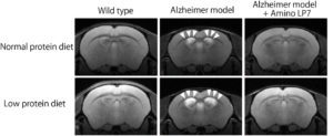 Essential Amino Acids Could Keep Dementia At Bay