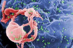 HIV Patient Clears Virus Naturally