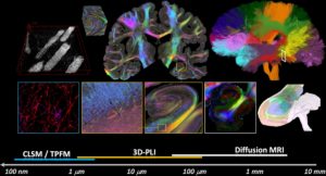 Brain-Inspired Technologies