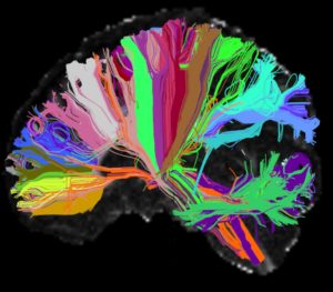 Mapping The Brain With Machine Learning
