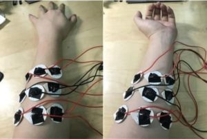 Hand To Prosthetic-Limb Gesture Accuracy