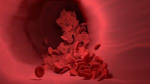 Gel-Like Sieve In Blood Vessels Repairs Damaged Hearts