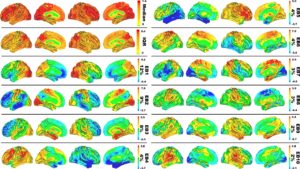 New Computational Model Proposed For Alzheimer’s Disease