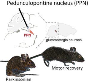 Improving Treatment For Parkinson’s