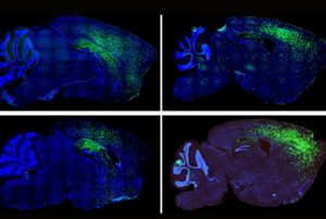 Autism Spectrum Disorder Symptoms Linked To Astrocytes