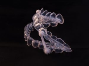 Mouthguard May Be