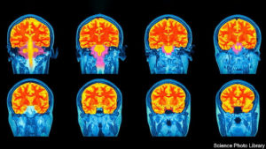 The First Aging Brain Reference Charts