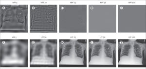 AI Predicts Race From Medical Images