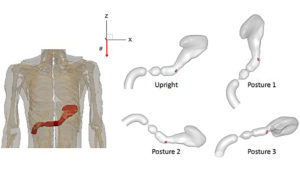 Body Posture Affects How Oral Drugs Absorbed