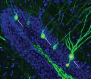 Neuron Formation Restores Memory In Mice With Alzheimer’s Disease