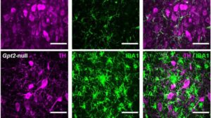 Brain Area Implicated In Alzheimer’s May Be Vulnerable To Degeneration