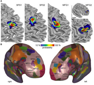 4 New Brain Areas Involved In Many Cognitive Processes