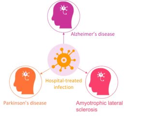 Repeated Infections Associated With Risk Of Neurodegenerative Diseases