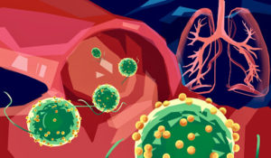 UCSD Develops Pneumonia Microbots