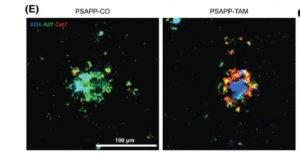 Alzheimer’s Disease Risk Gene & The Brain