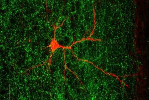 Autism-Linked Gene Shapes Nerve Connections