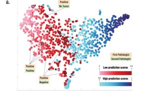 Pathologists Declining, AI Becoming A Diagnostic Tool – MEDICAL-HEALTH Dx