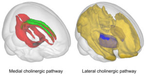 Early Brain Changes In Alzheimer’s Disease