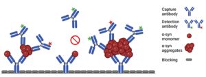 Stool Samples As An Indicator Of Early Form Of Parkinson’s