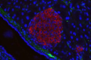 Human MicroRNAs Linked To Type 2 Diabetes