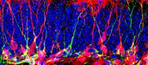 How To Generate New Neurons In The Brain^