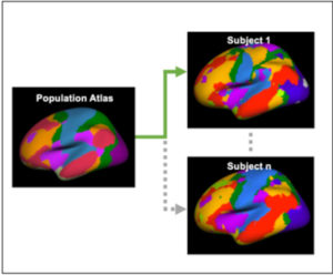 Brain Fingerprints Uncover Early Signs Of Alzheimer’s Disease