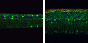 Gene-Editing Reverses Vision Loss In Mice