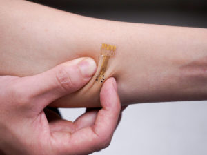 ‘Smart’ Bandages Monitor Wounds And Provide Targeted Treatment