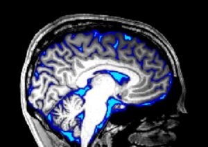 Fluid Flow & Neutrician In The Brain Can Be Manipulated By Sensory Stimulation