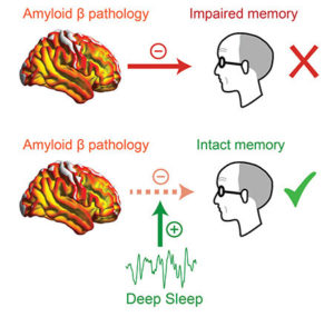 DEEP SLEEP MITIGATES ALZHEIMER’S MEMORY LOSS