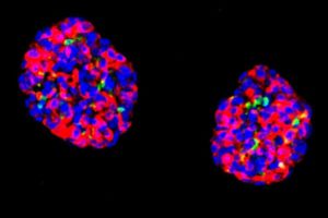 Human Stomach Cells For Diabetes Therapy