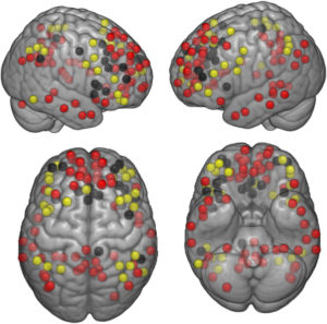 Memory Improves In Older Adults After Walking – Alzheimer’s – 3P™