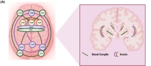 Creative Therapies Can Help With Neurodegenerative Diseases – 3P™