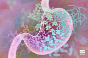 Lupus Flare-Ups Strongly Linked To Specific Bacterial Growth In Gut