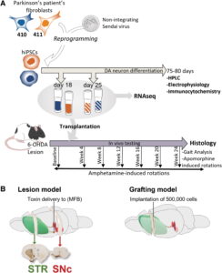 Parkinson’s Patient-Specific Stem Cell Tx – 3P™