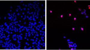 “Holy Grail” Molecule Destroys All Types Of Solid Cancer Tumors