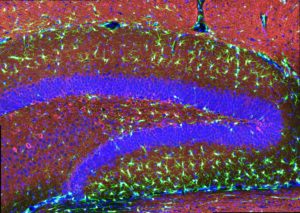 Mutation In Microglia Elevates Alzheimer’s Risk – A4DP™