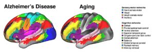 Impact Of Alzheimer’s On Brain Function – A4DP™