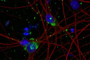 Human neuron model paves the way for new Alzheimer’s therapies  – A4DP™