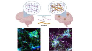 Alzheimer’s disease mechanisms through novel hydrogel matrix – A4DP™